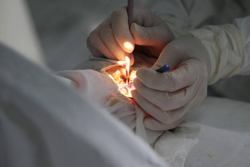 v pogone za krasotoj paczienty popadayut k lzheplasticheskim hirurgam