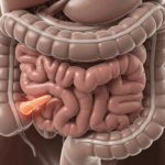 Где находится аппендицит 5 важных фактов о боли