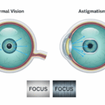 Астигматизм глаз что это, 7 фактов о зрении